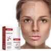DARK SPOT CREAM