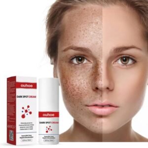 DARK SPOT CREAM